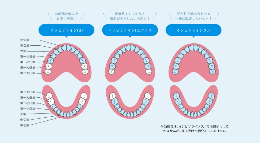 インビザライン3つの違い