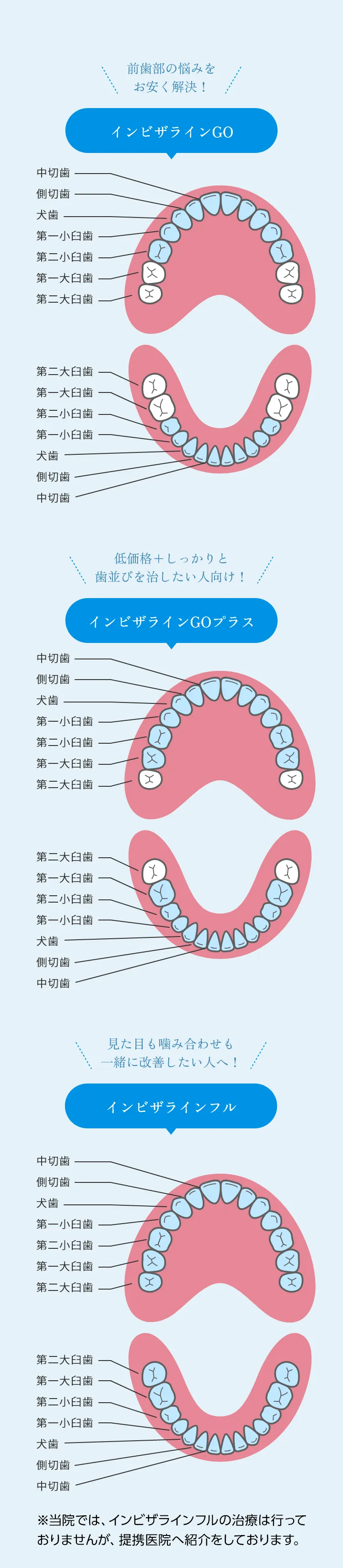 インビザライン3つの違い